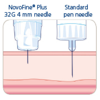 Иглы для инсулиновых шприц-ручек Новофайн Плюс 4 мм - Novofine Plus  4 мм 32G, поштучно (фасовка по 25 шт.)