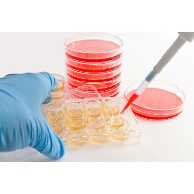 Сахарный диабет излечим с помощью стволовых клеток