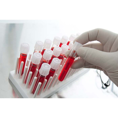 Лазерные технологии помогут определить уровень сахара